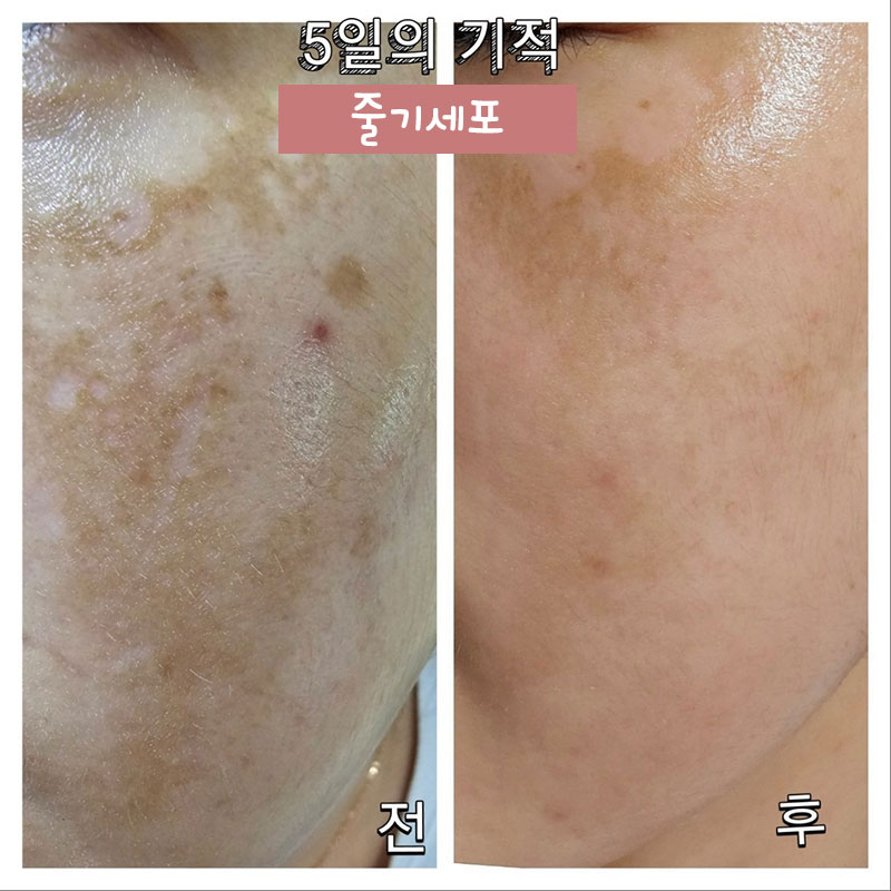 피부 재생을 잘하는 세라뷰티 스킨케어