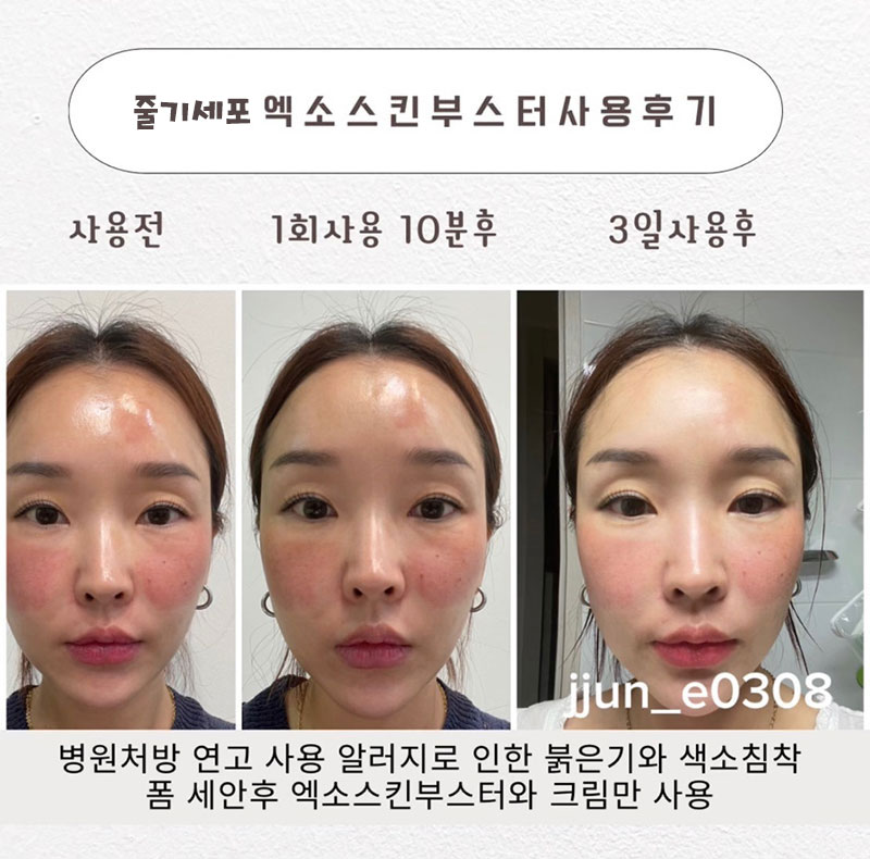 콜라겐으로 젊어지는 세라뷰티 스킨케어